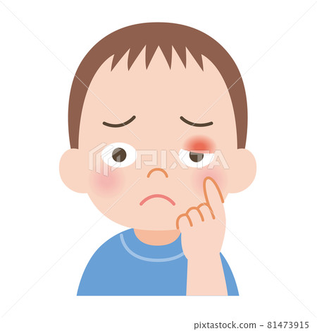 Boy with swollen eyelids 81473915