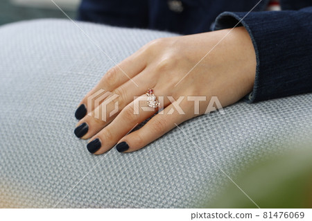 手 81476069