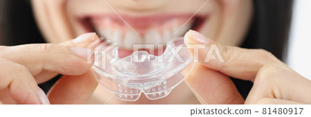 Smiling woman holding plastic mouth guard for teeth whitening Smiling woman holding plastic mouth guard for teeth whitening 81480917