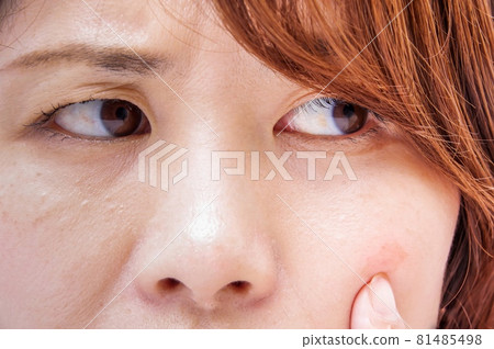 關心臉頰的女人 81485498