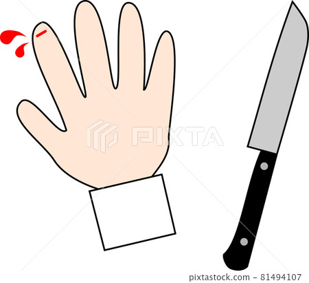 Image of cutting hands with a kitchen knife 81494107