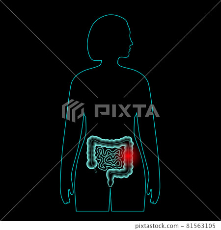 Intestine pain concept 81563105