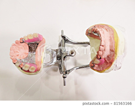 Maxillary and mandibular partial dentures Maxillary and mandibular partial dentures 81563166