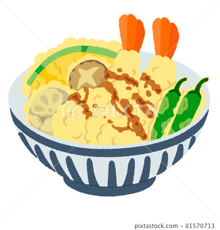 Illustration of Tendon 81570713