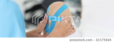 Therapist gluing blue kinesio tapes on woman sore knee closeup 81575684