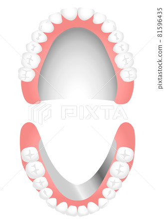Dentures (metal floor) 81596435