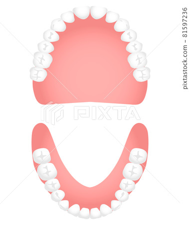 Denture (complete denture) occlusal surface 81597236