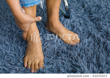 Woman sitting and using hand to hold leg and feeling pain, suffer, hurt and tingling. Concept of Guillain barre syndrome and numb hands disease effect 81635831