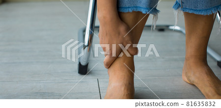 Woman sitting and using hand to hold leg and feeling pain, suffer, hurt and tingling. Concept of Guillain barre syndrome and numb hands disease effect Woman sitting and using hand to hold leg and feeling pain, suffer, hurt and tingling. Concept of Guillain barre syndrome and numb hands disease effect 81635832
