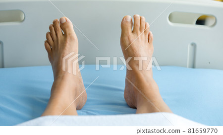 Feet of patient on bed in hospital room. Concept of Guillain barre syndrome and numb hands disease or vaccine side effect Feet of patient on bed in hospital room. Concept of Guillain barre syndrome and numb hands disease or vaccine side effect 81659770