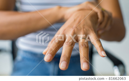 Woman in using hand to hold wrist and stretching fingers. with feeling pain, suffer, hurt and tingling. Concept of Guillain barre syndrome and numb hands disease 81662063