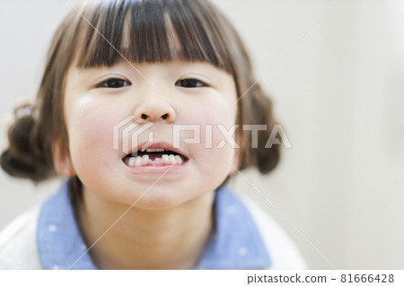 錯過牙齒的女孩 81666428