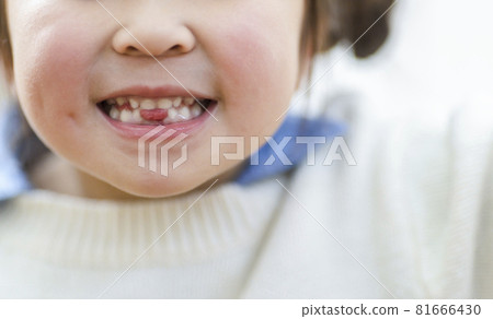 Girls who have missed teeth 81666430