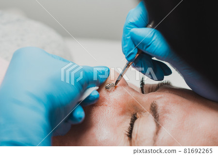 Mechanical cleansing of the face with a spoon uno, removing grease and blackheads. 81692265