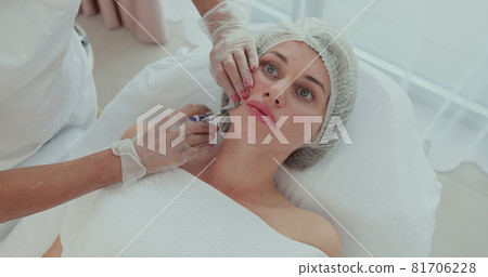 Hands of beautician make injections of hyaluronic acid in lower lip of the girl. Aesthetic cosmetology. Top view. Hands of beautician make injections of hyaluronic acid in lower lip of the girl. Aesthetic cosmetology. Top view. 81706228