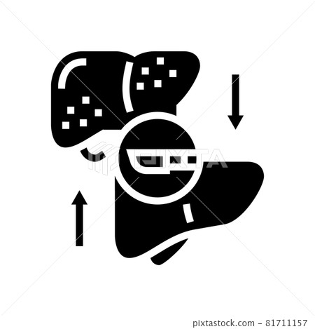 liver transplant glyph icon vector illustration 81711157