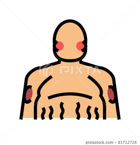 cushing disease endocrinology color icon vector illustration cushing disease endocrinology color icon vector illustration 81712728
