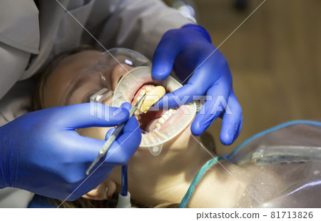 The procedure of augmentation of the front teeth, a girl patient aged 11 years 81713826