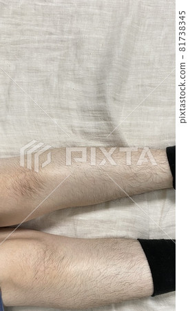 A woman's hairy legs, knees and partially removed socks 81738345
