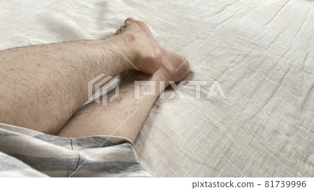 一個女人的膝蓋和腿有很多不必要的頭髮 81739996