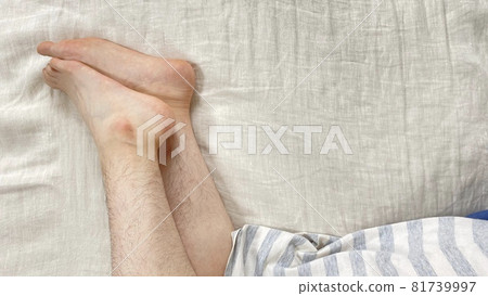 一個女人的膝蓋和腿有很多不必要的頭髮 81739997