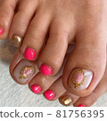 nail  81756395
