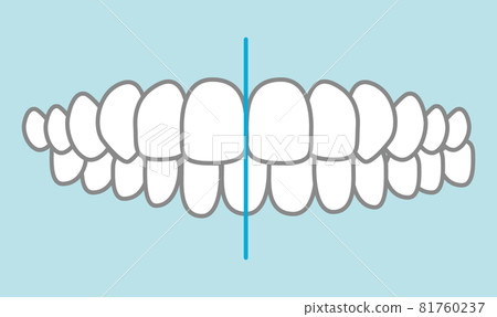 聯鎖插圖 81760237