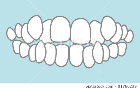 聯鎖插圖 81760239