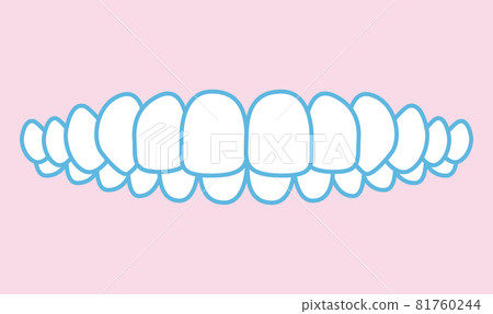 Illustration of bite alignment 81760244