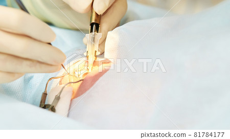 Ophthalmology laser microscope operation. Doctor in clinic. Patient eye 81784177