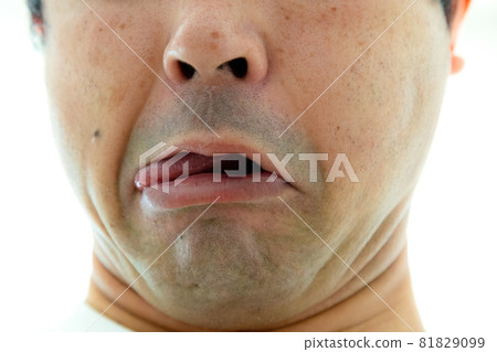 A man with a strange face, sticking out his tongue and having a gloomy look A man with a strange face, sticking out his tongue and having a gloomy look 81829099
