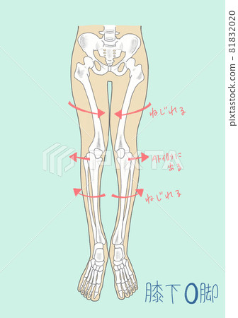 Skeleton of O leg below the knee 81832020
