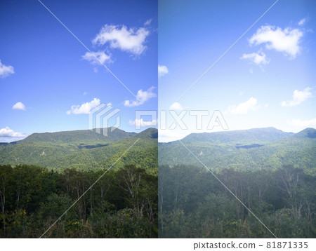 白內障的外觀圖片 81871335