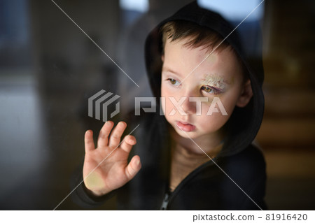Poor sad small boy with cut eyebrow standing indoors at home, poverty concept. 81916420