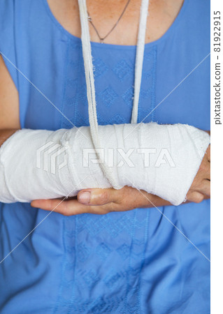 senior woman with a rewound arm in a cast and bandage. Blow, fracture, bones, hospital. 81922915