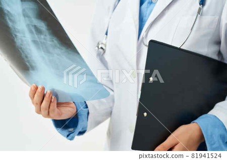 doctor in white coat x-ray close-up clinic 81941524