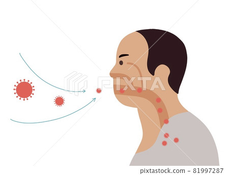 Corona Virus ,Bacteria and Fungi into respiratory of human from breathe. Illustration about air pollution 81997287