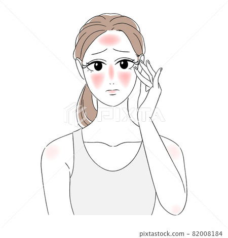 Women's beautiful skin, skin troubles, beauty skin care, sunburn, red skin, worried face, troubled face, tank top Women's beautiful skin, skin troubles, beauty skin care, sunburn, red skin, worried face, troubled face, tank top 82008184