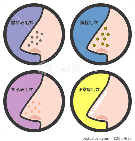Illustration of a pattern showing the condition of the pores in the nose 82034653