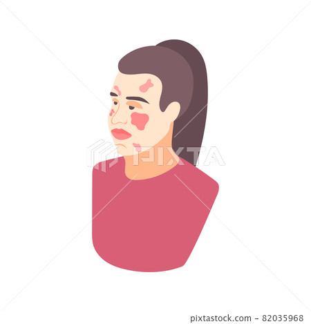 Allergy Symptoms Icon 82035968