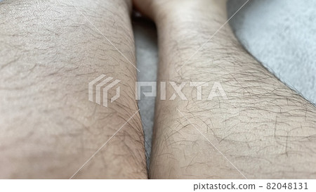 Female shin with lots of unwanted hair Female shin with lots of unwanted hair 82048131