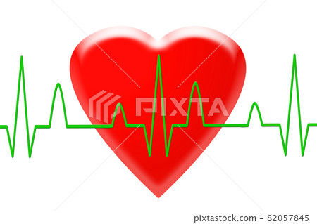 ECG waveform image 82057845