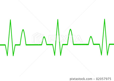 ECG waveform image ECG waveform image 82057975
