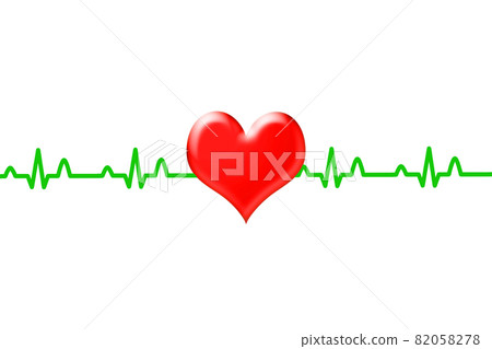 ECG waveform image 82058278