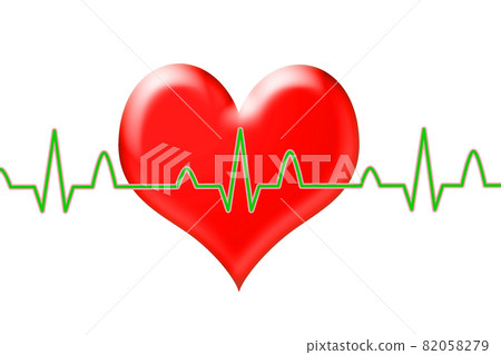 ECG waveform image 82058279