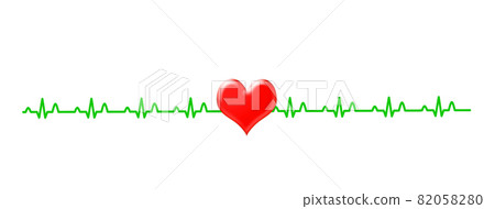 ECG waveform image 82058280