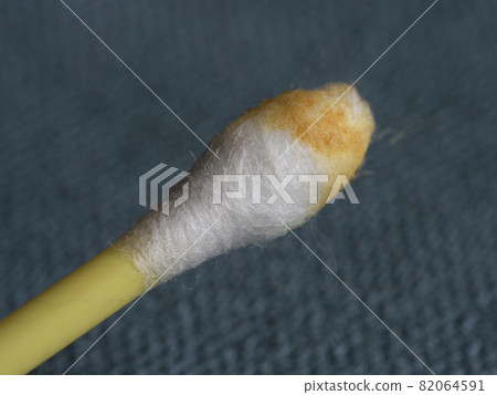 Earwax on a cotton swab, macro photo. Earwax, also known by the medical term cerumen, is a brown, orange, red, yellowish or gray waxy substance secreted in the ear canal of humans and other mammals. Earwax on a cotton swab, macro photo. Earwax, also known by the medical term cerumen, is a brown, orange, red, yellowish or gray waxy substance secreted in the ear canal of humans and other mammals. 82064591