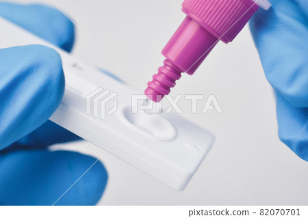 Hand placing the secretions sample into the rapid antigen test kit (ATK) with the extraction tube 82070701