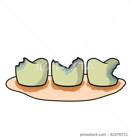 Caries and dental problems. Dentistry and sick dirty teeth. Caries and dental problems. Dentistry and sick dirty teeth. 82076551