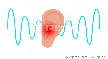 Tinnitus disease concept 82078144